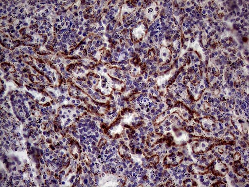 KLRB1 / CD161 Antibody (aa67-225, clone OTI1D8)
