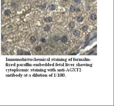 AGXT2 Antibody (Internal)