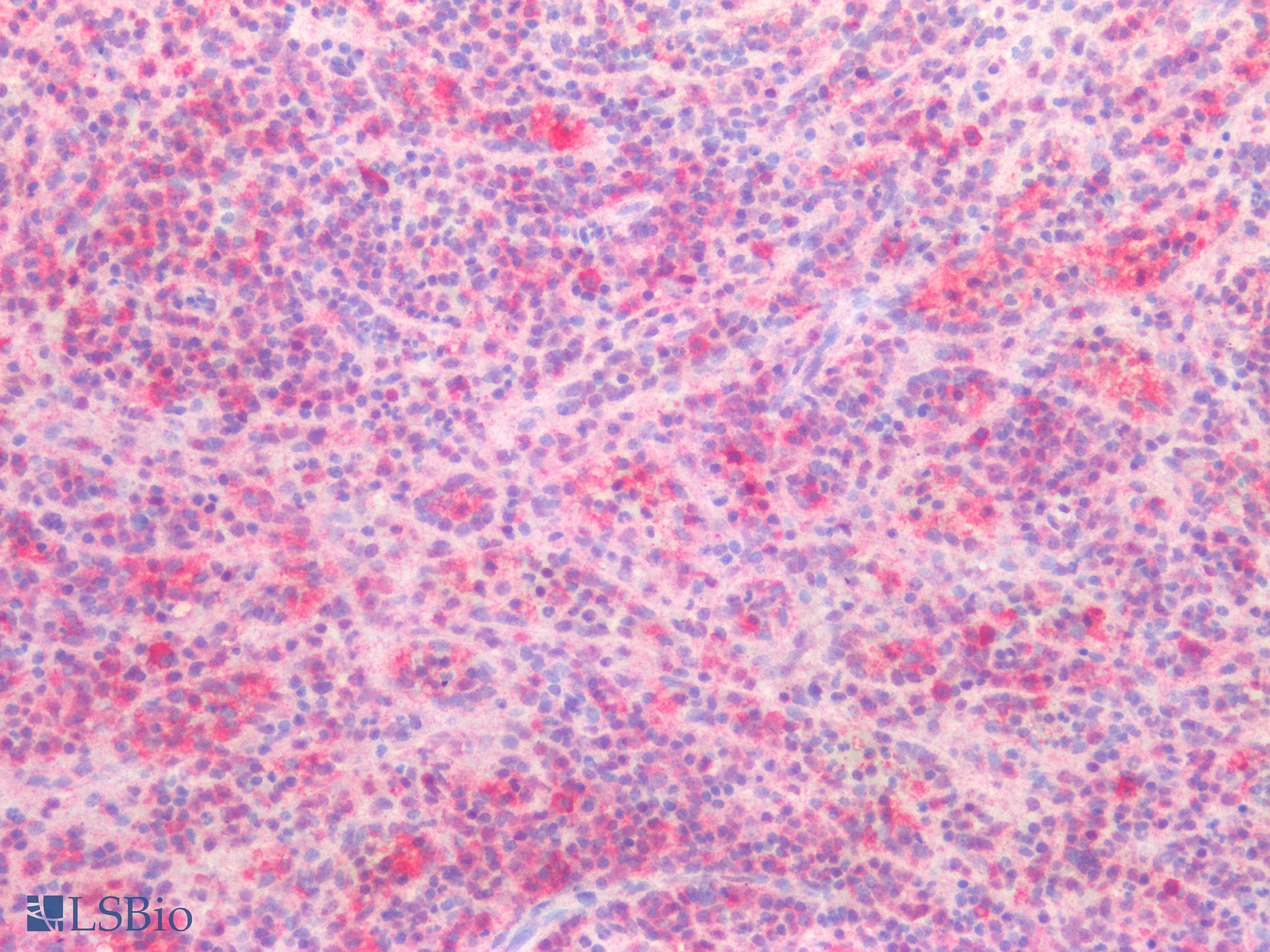 IHC-plus™ Polyclonal Rabbit anti-Human GATA3 Antibody (IHC)
