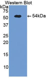 SELE / CD62E / E-selectin Antibody (aa260-420, Cy3)