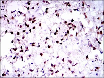 Monoclonal Mouse anti-Human PAX5 Antibody (clone 7D3, Amino Acid: 235-382, IHC, WB)