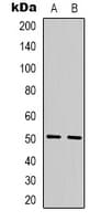 TBL2 Antibody (C-Terminus)