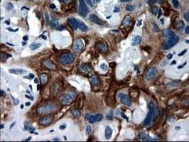 KRT18 / CK18 / Cytokeratin 18 Antibody (clone OTI1E1)