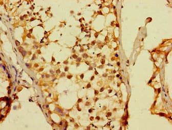 Polyclonal Rabbit anti-Human DUX4 Antibody (IHC)
