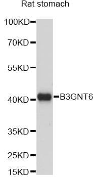 Polyclonal Rabbit anti-Human B3GNT6 Antibody (WB)