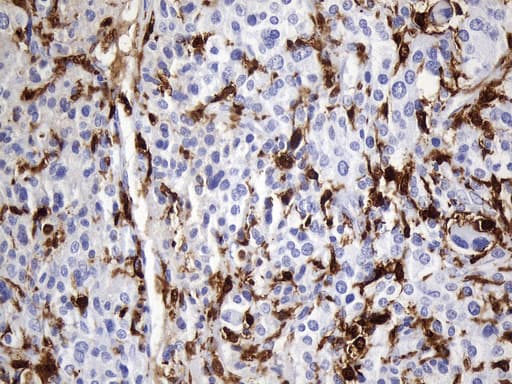 F13A1 / Factor XIIIa Antibody (clone UMAB243)