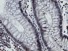 MIPEP Antibody (aa174-516, clone OTI3F8, Carrier-free)