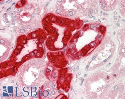 Polyclonal Rabbit anti-Human RHCG Antibody (IHC)