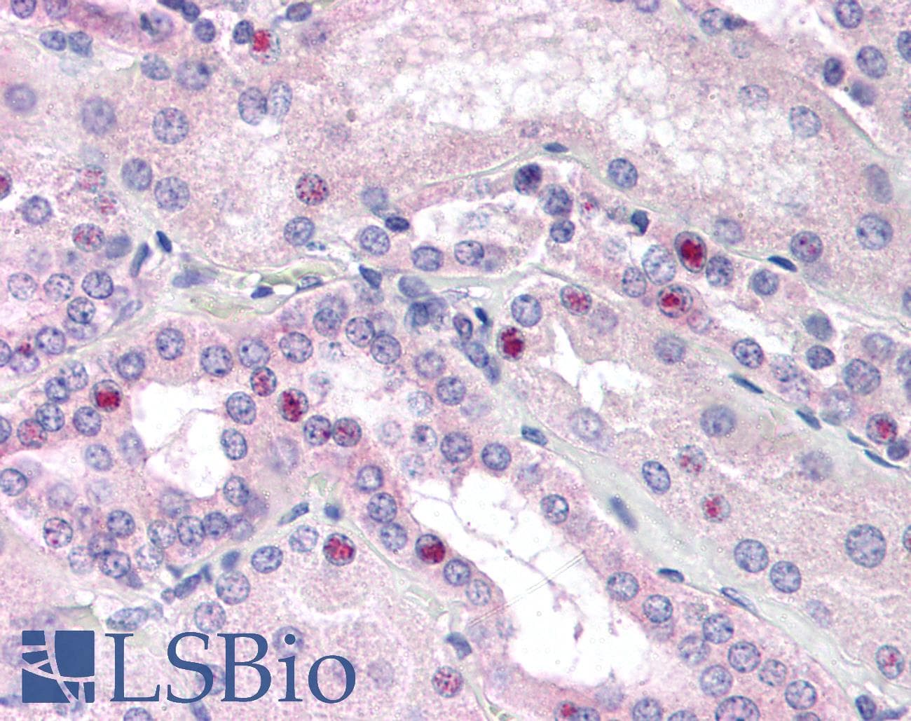 IHC-plus™ Monoclonal Mouse anti-Human C/EBP Beta / CEBPB Antibody (clone 21A1, aa39-78, IHC, WB)