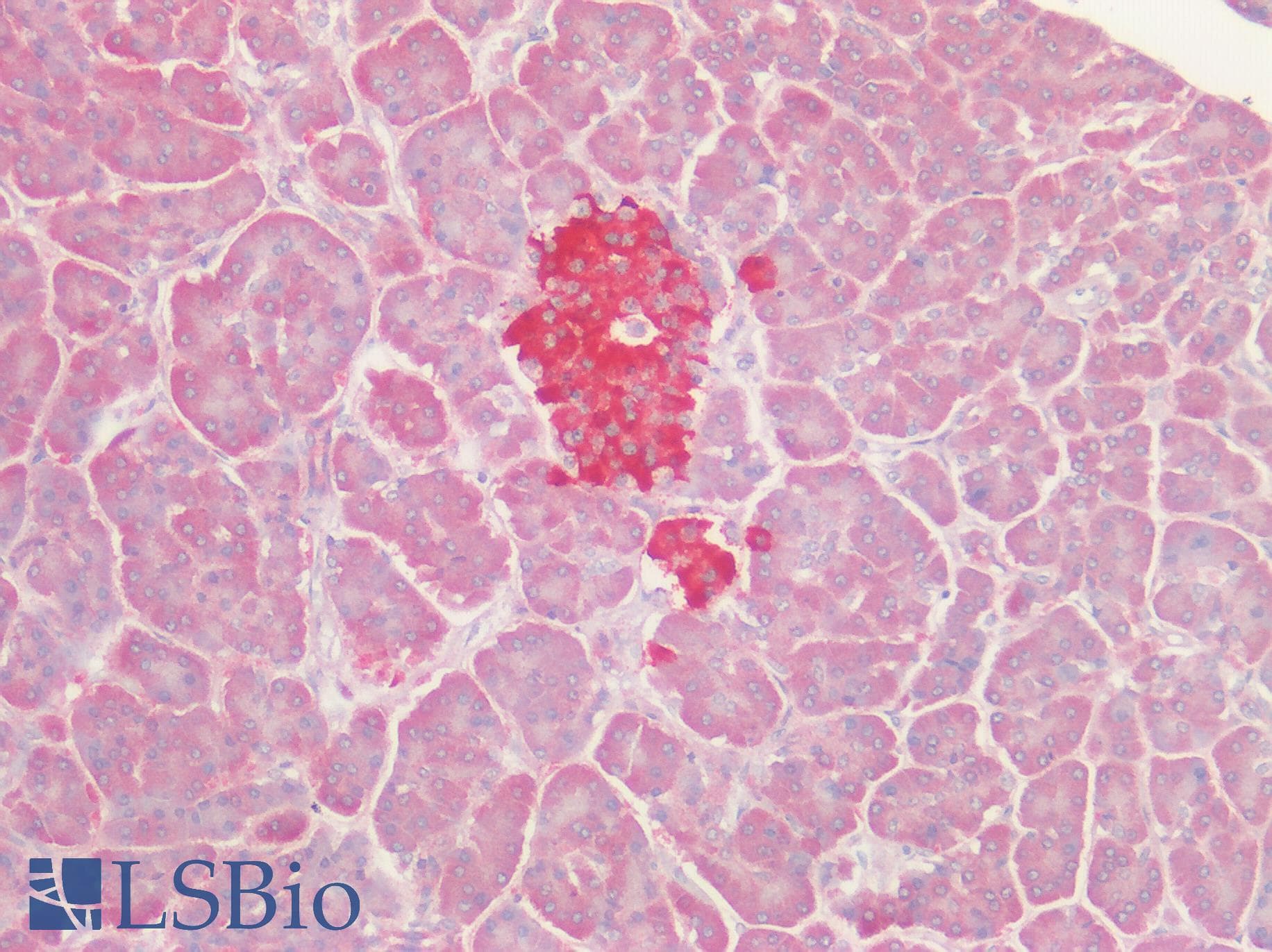 IHC-plus™ GPRC5D Antibody (Cytoplasmic Domain)