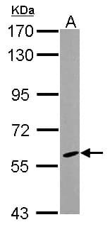 Polyclonal Rabbit anti-Human CYP46A1 / CYP46 Antibody (WB)