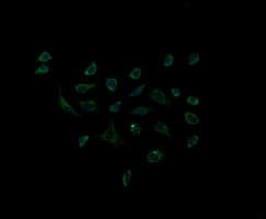 ACAA2 Antibody (clone OTI3C6)