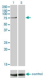 PRKCI / PKC Iota Antibody (clone 1G11)