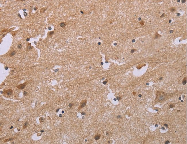 ACVR2 / ACVR2A Antibody