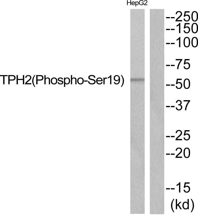 TPH2 Antibody (phospho-Ser19)