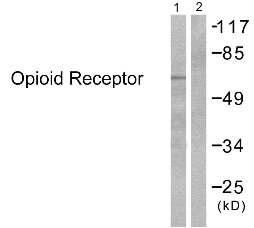 OPRM1 / Mu Opioid Receptor Antibody (p375)