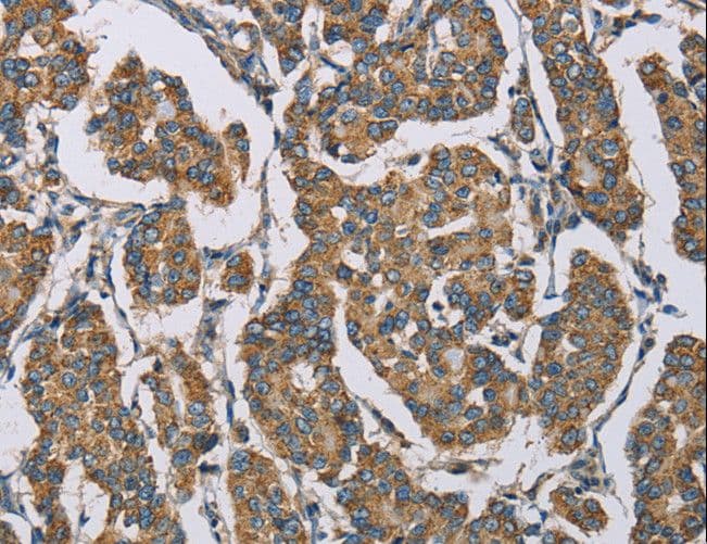 Polyclonal Rabbit anti-Human HDAC6 Antibody (IHC)