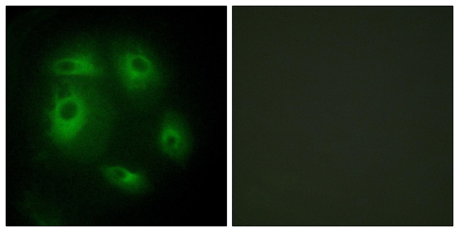 Polyclonal Rabbit anti-Human DLEC1 / DLC1 Antibody (IHC, IF)