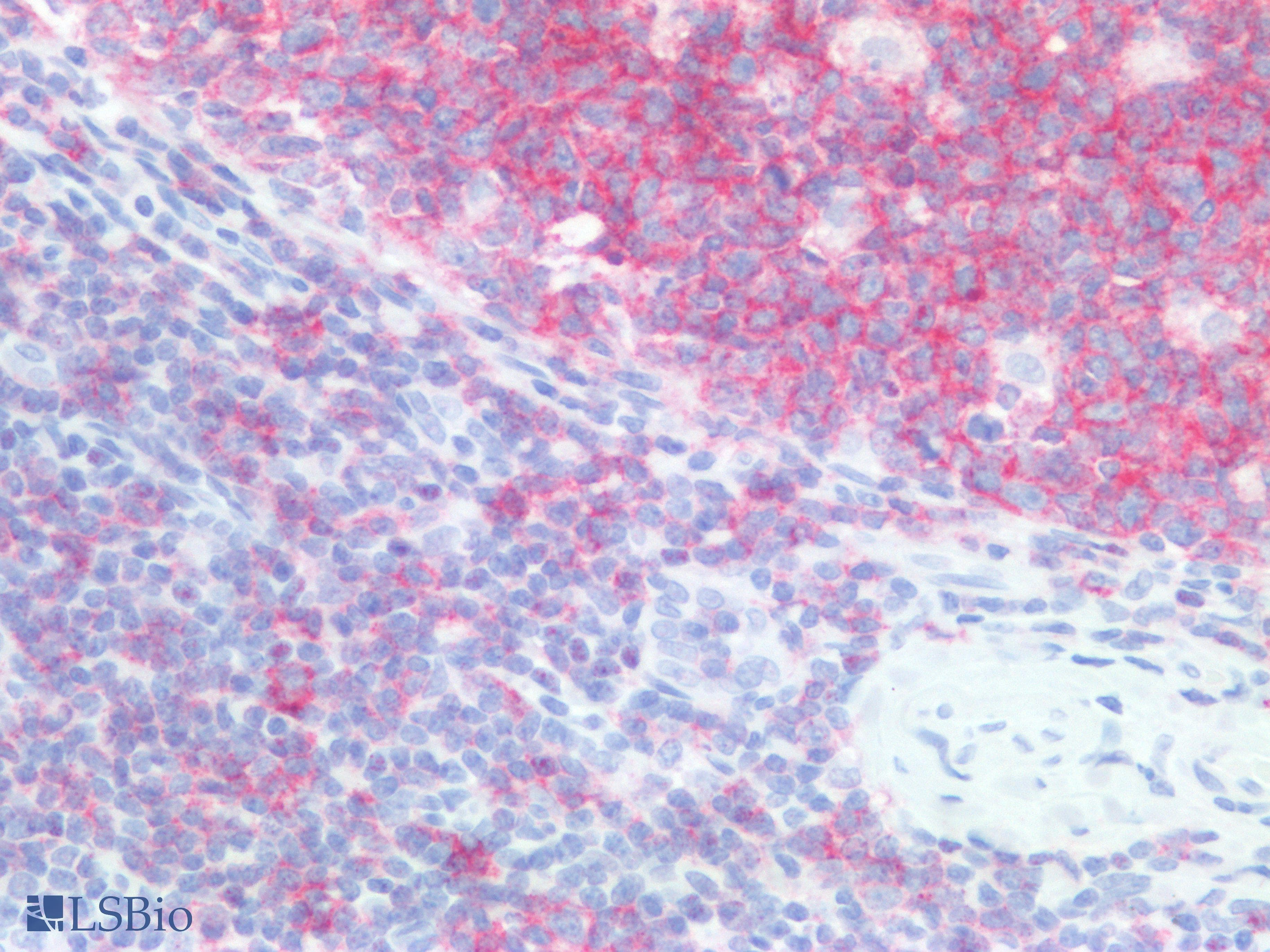 PathPlus™ CD20 Antibody