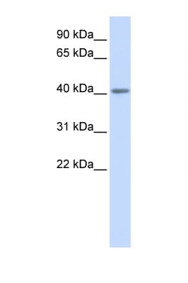 Polyclonal Rabbit anti-Human HTR5A / 5-HT5A Receptor Antibody (N-Terminus, WB)