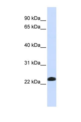 CAV2 / Caveolin 2 Antibody (aa36-85)