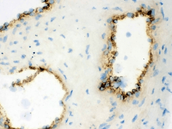 Polyclonal Rabbit anti-Human VWF / Von Willebrand Factor Antibody (aa2535-2813, IHC, WB)