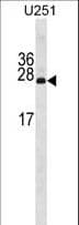 Polyclonal Rabbit anti-Human PDAP1 Antibody (aa1-30, WB)