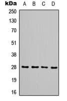 TIMP1 Antibody (Internal)