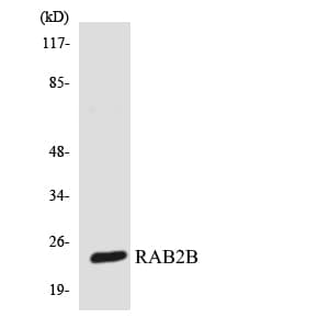 RAB2B Antibody (aa86-135)