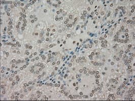 NTRK3 / TRKC Antibody (clone OTI24B3)
