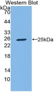 TLN1 / Talin 1 Antibody (aa975-1181, FITC)