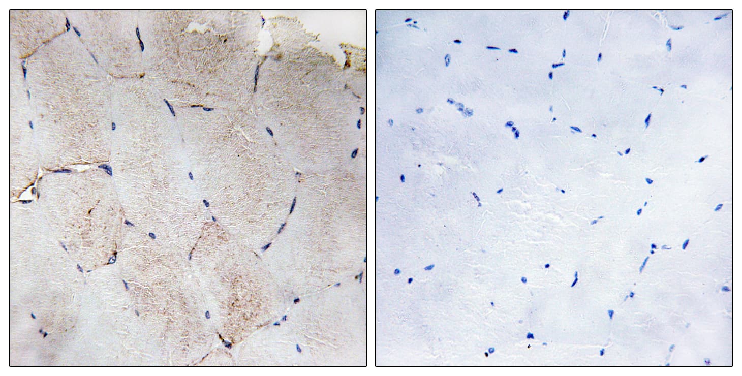 Collagen XII Alpha 1 Antibody (aa1481-1530)