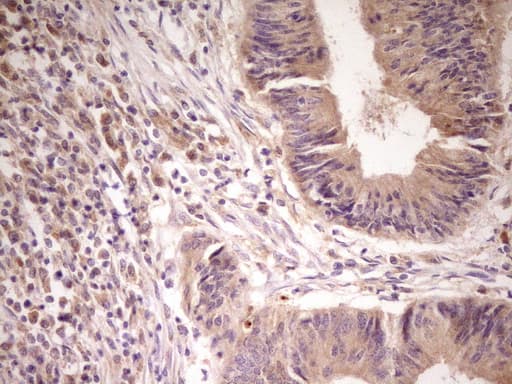 ACVR2 / ACVR2A Antibody (aa214-513, clone OTI5D1)