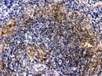 ACTA1 / Skeletal Muscle Actin Antibody