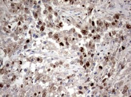 MKI67 / Ki67 Antibody (aa1160-1493, clone OTI16E9)