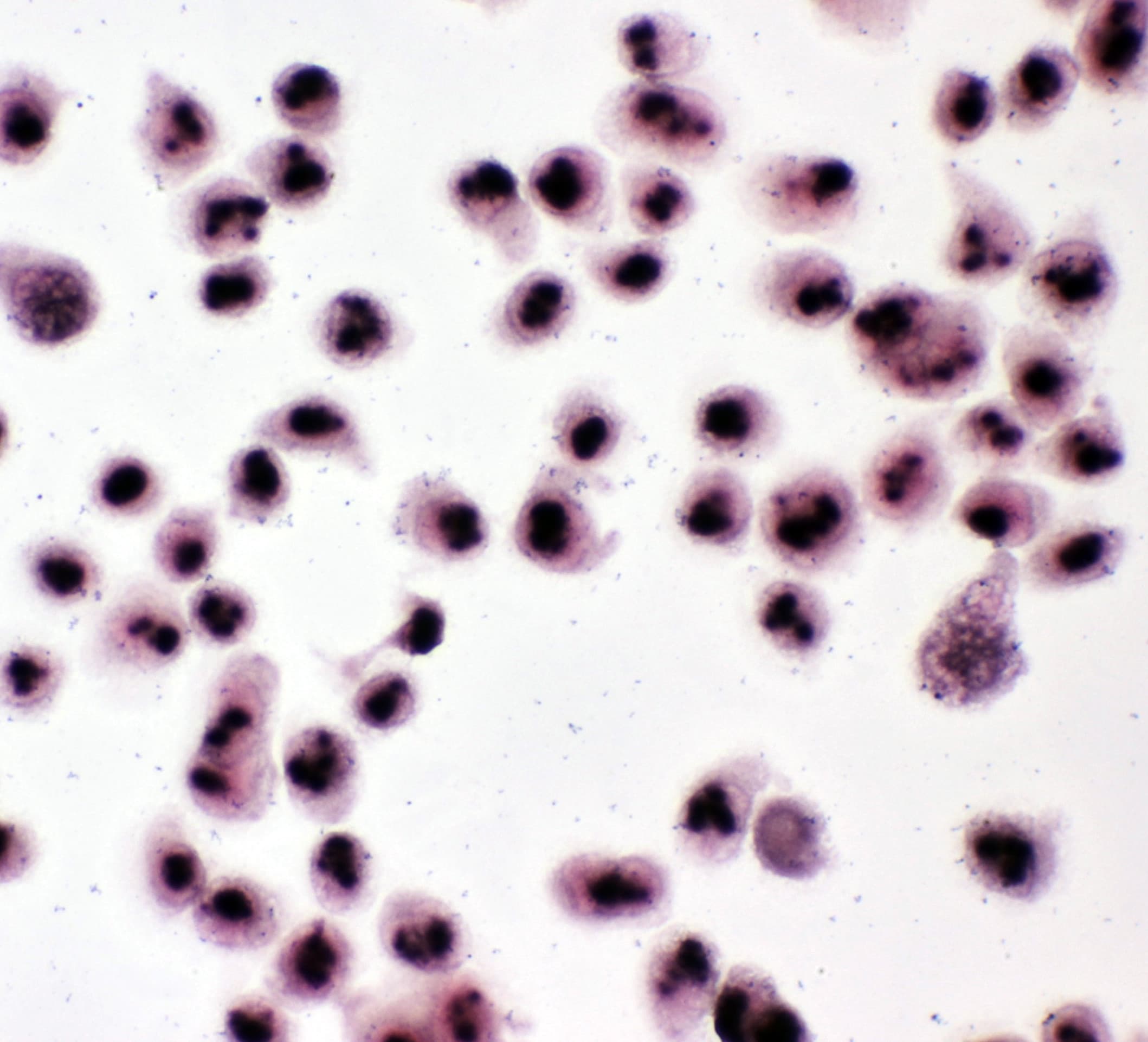 Polyclonal Rabbit anti-Human NPM1 / NPM / Nucleophosmin Antibody (aa22-41, IHC, WB)
