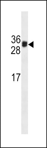 KLK3 / PSA Antibody (aa220-250)