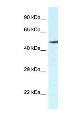 Polyclonal Rabbit anti-Human VNN2 Antibody (aa337-386, WB)