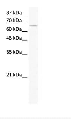 CACNB2 Antibody (N-Terminus)