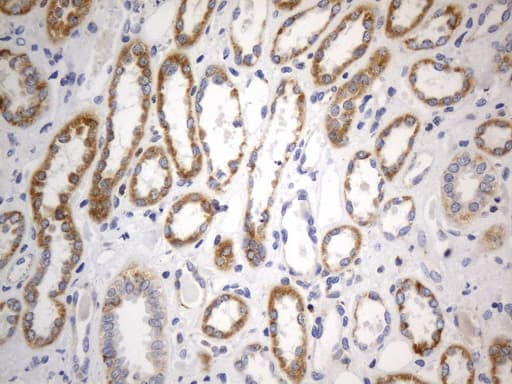 Monoclonal Mouse anti-Human SDHB Antibody (clone UMAB268, IHC, WB)
