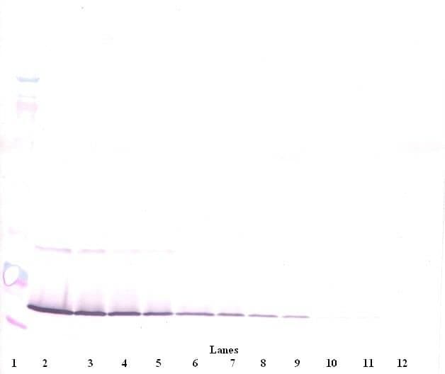 IFN Gamma / Interferon Gamma Antibody (Biotin)