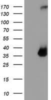 TPSG1 / Tryptase Gamma 1 Antibody (aa20-283, clone OTI1G1)