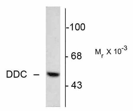 PathPlus™ DDC / DOPA Decarboxylase Antibody (N-Terminus)
