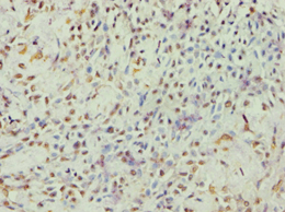 Polyclonal Rabbit anti-Human ARF6 Antibody (aa1-175, IHC, WB)