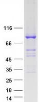 Human BRAT1 / BAAT1 Protein (Recombinant Myc-DDK (Flag))