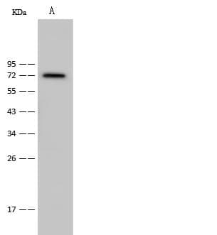 CAMK2B / CaMKII Beta Antibody (Preservative Free)