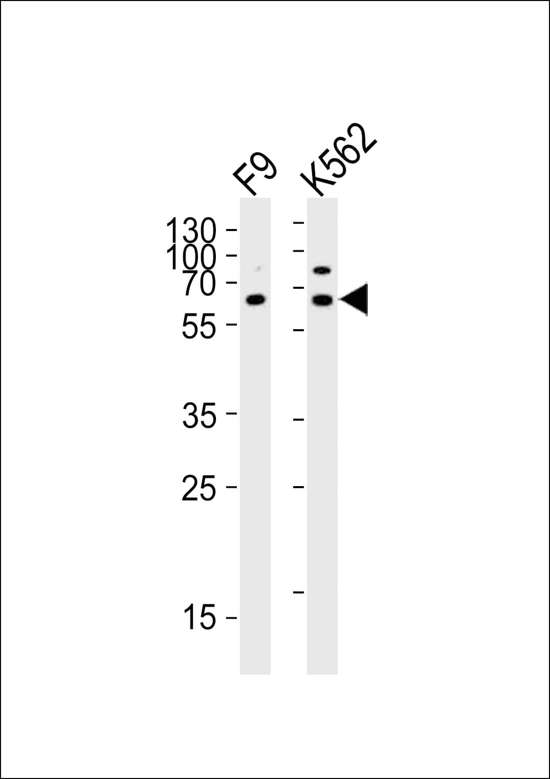ASH2L / ASH2 Antibody (aa237-270)