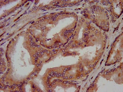 Polyclonal Rabbit anti-Human CLN5 Antibody (IF)