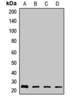 ARHGDIB / D4 GDI Antibody