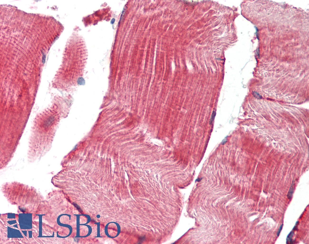 Polyclonal Rabbit anti-Human TNK1 Antibody (aa517-566, IHC, WB)